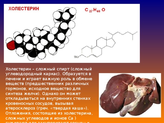 Холестерин – сложный спирт (сложный углеводородный каркас). Образуется в печени и играет важную роль в обмене веществ (предшественник различных гормонов, исходное вещество для синтеза желчи). Однако он может откладываться на внутренних стенках кровеносных сосудов, вызывая атеросклероз (греч. «твердая каша»). Отложения, состоящие из холестерина, сложных углеводов и ионов Са ) суживают или закупоривают сосуды и могут привести к ишемической болезни. 
