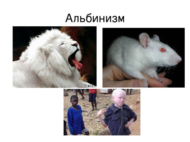Альбинизм 