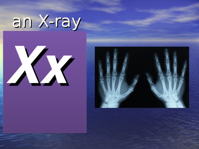 an X-ray Xx 