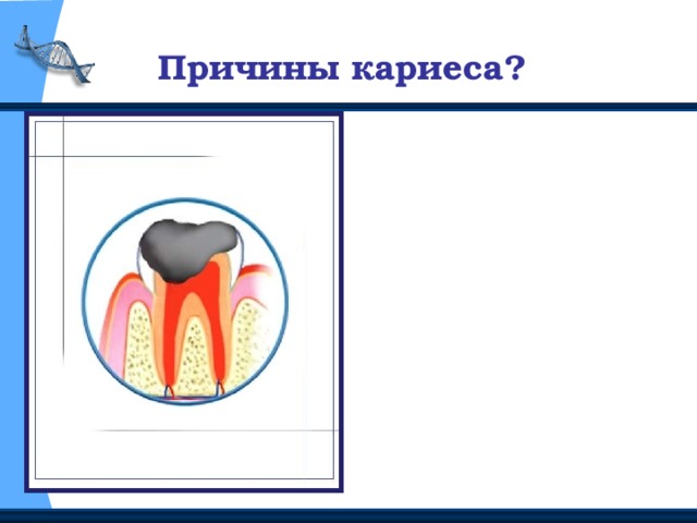 Кариес причины