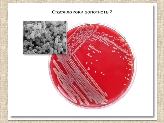Спектр действия антибиотиков 