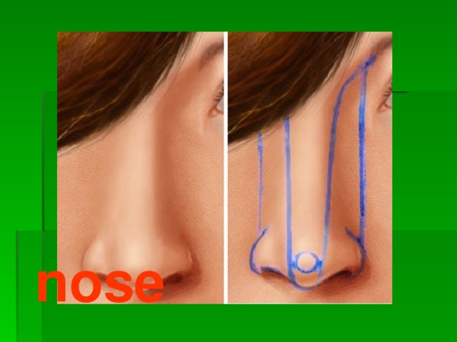 nose 