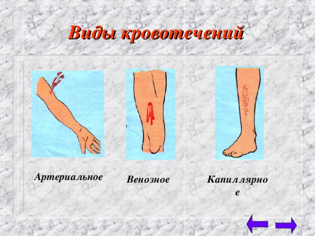 Артериальное от венозного отличия