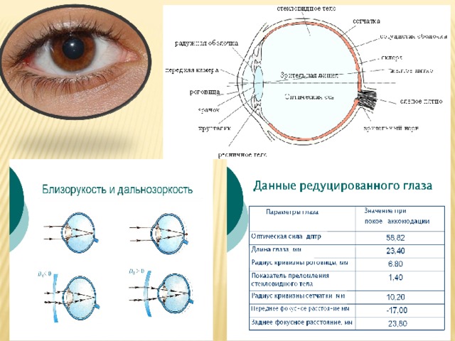 Построение изображения на сетчатке редуцированного глаза