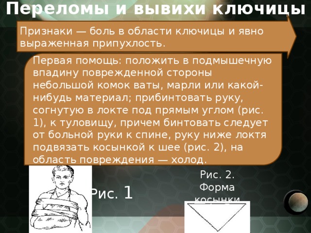 Используя приведенный перечень буквами обозначьте на схеме порядок медицинской помощи при вывихе