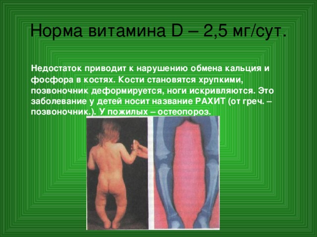 Норма витамина D – 2,5 мг/сут.  Недостаток приводит к нарушению обмена кальция и фосфора в костях. Кости становятся хрупкими, позвоночник деформируется, ноги искривляются. Это заболевание у детей носит название РАХИТ (от греч. – позвоночник.). У пожилых – остеопороз. 
