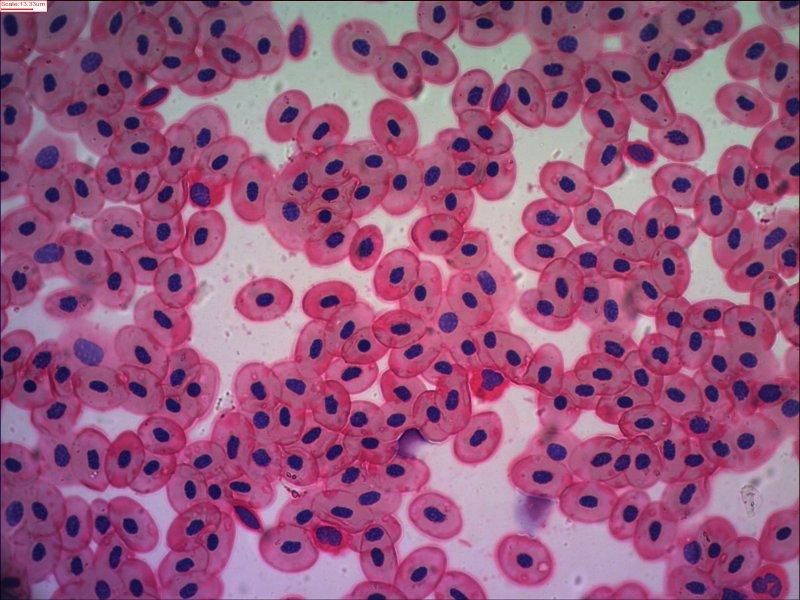 Фото под микроскопом клеток крови