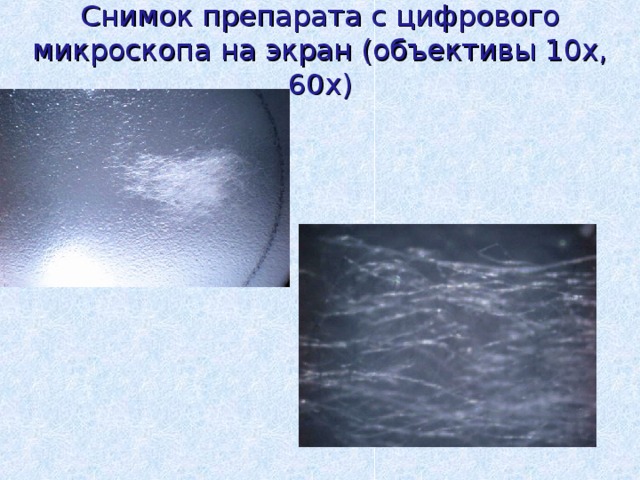 Снимок препарата с цифрового микроскопа на экран (объективы 10х, 60х) 