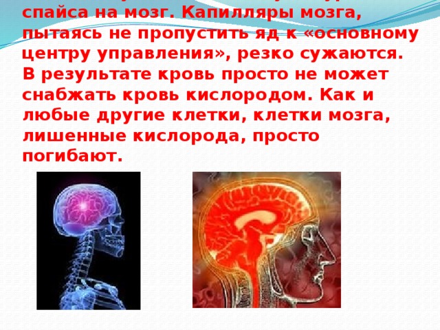 Кислород через мозг. Кровь не поступает в мозг. Насытить мозг кислородом.