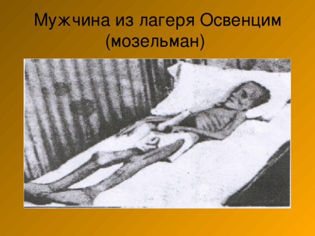 Мужчина из лагеря Освенцим  (мозельман) 