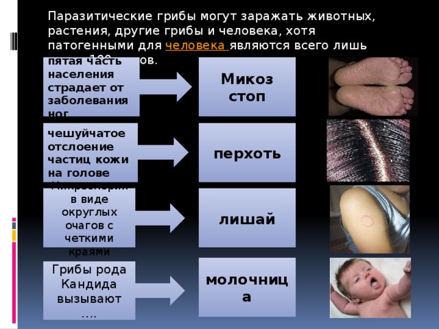 Паразитические грибы могут заражать животных, растения, другие грибы и человека, хотя патогенными для человека являются всего лишь около 100 видов. пятая часть населения страдает от заболевания ног Микоз стоп чешуйчатое отслоение частиц кожи на голове перхоть Микроспория в виде округлых очагов с четкими краями лишай молочница Грибы рода Кандида вызывают …. 