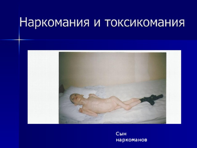 Сын наркоманов 