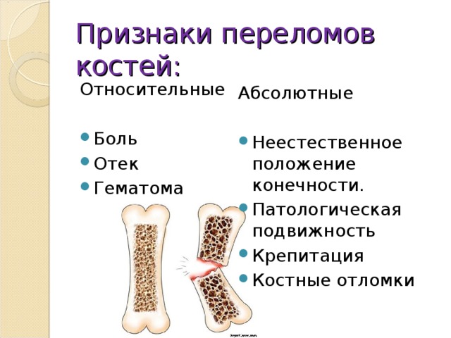 Для перелома характерно тест. Основным симптомом перелома трубчатых костей является:. Основной симптом перелома трубчатых костей. Перелом длинных трубчатых костей симптомы. Перелом трубчатых костей симптомы.