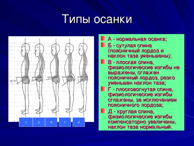 Поясничный лордоз фото