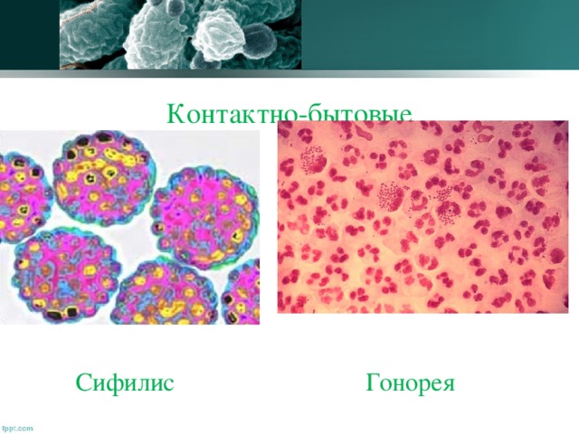 Презентация гонорея обж