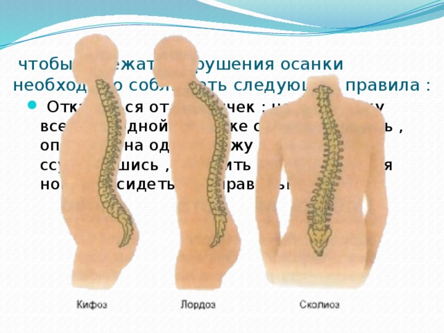 Чтобы избежать нарушения осанки надо. Чтобы избежать нарушения осанки надо. Правило хорошей осанки. Правила формирования правильной осанки. Правила сохранения осанки.