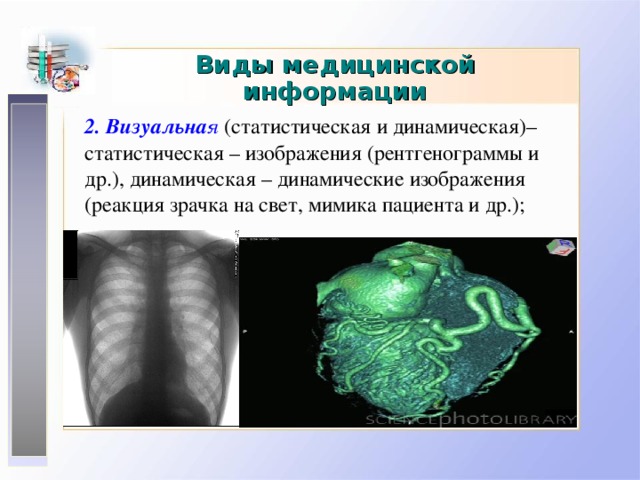 Виды медицинской информации 2. Визуальна я (статистическая и динамическая)– статистическая – изображения (рентгенограммы и др.) , динамическая – динамические изображения (реакция зрачка на свет , мимика пациента и др.); 