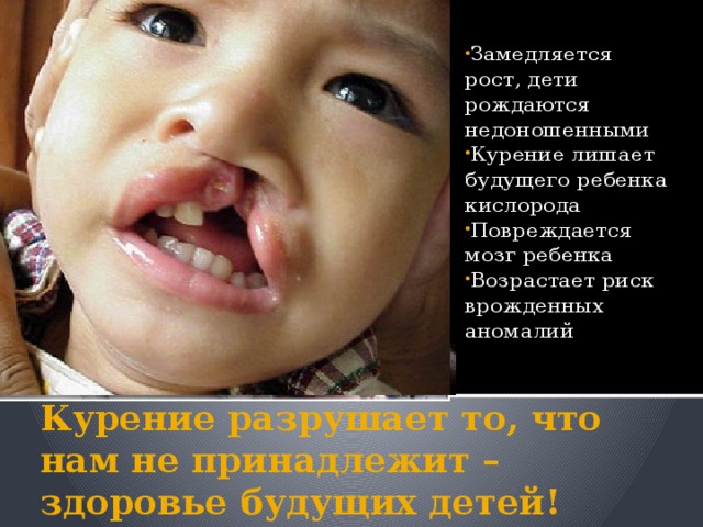Замедляется рост, дети рождаются недоношенными Курение лишает будущего ребенка кислорода Повреждается мозг ребенка Возрастает риск врожденных аномалий Курение разрушает то, что нам не принадлежит – здоровье будущих детей! 