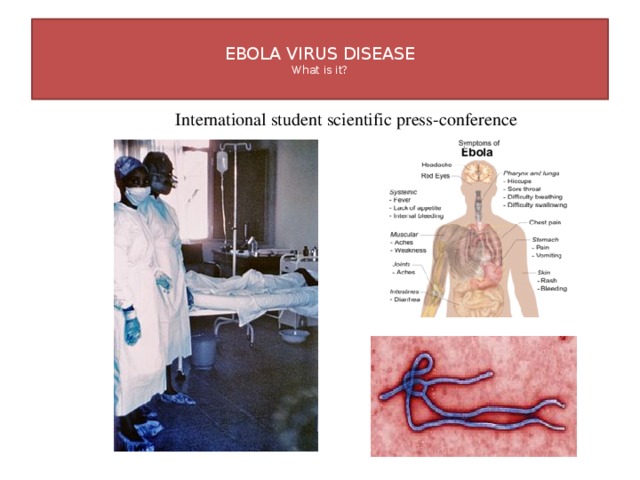  EBOLA VIRUS DISEASE  What is it?   International student scientific press-conference 