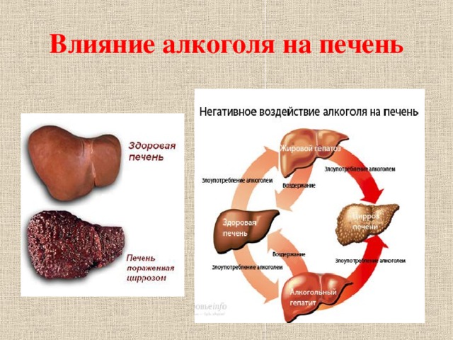 Печень алкоголика и здорового человека реальные фото Презентация ко Дню Здоровья "Вредные привычки"