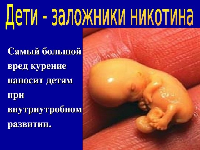Самый большой вред курение наносит детям при внутриутробном развитии. 