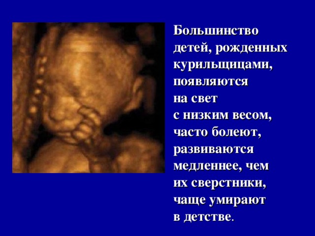 Большинство детей, рожденных курильщицами, появляются на свет с низким весом, часто болеют, развиваются медленнее, чем их сверстники, чаще умирают в детстве . 