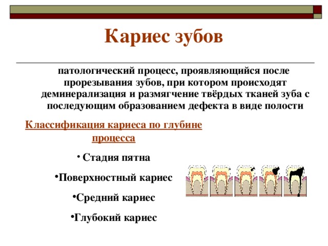 Кариес зубов   патологический процесс, проявляющийся после прорезывания зубов, при котором происходят деминерализация и размягчение твёрдых тканей зуба с последующим образованием дефекта в виде полости  Классификация кариеса по глубине процесса  Стадия пятна Поверхностный кариес Средний кариес Глубокий кариес      