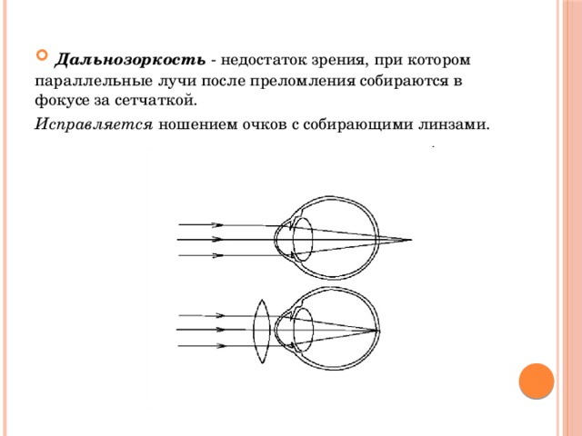 Презентация дефекты зрения очки