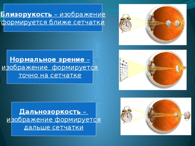 Как формируется изображение предметов на сетчатке