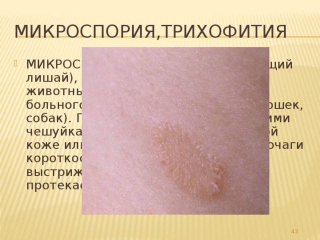 Микроспория,трихофития МИКРОСПОРИЯ, трихофития (стригущий лишай), дерматомикоз человека и животных. Заражение человека от больного человека или животных (кошек, собак). Проявления: покрытые мелкими чешуйками розовые пятна на гладкой коже или волосистой части головы; очаги короткообломанных (как бы выстриженных) волос. У животных протекает чаще в скрытой форме. 32 