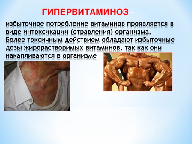 ГИПЕРВИТАМИНОЗ - 