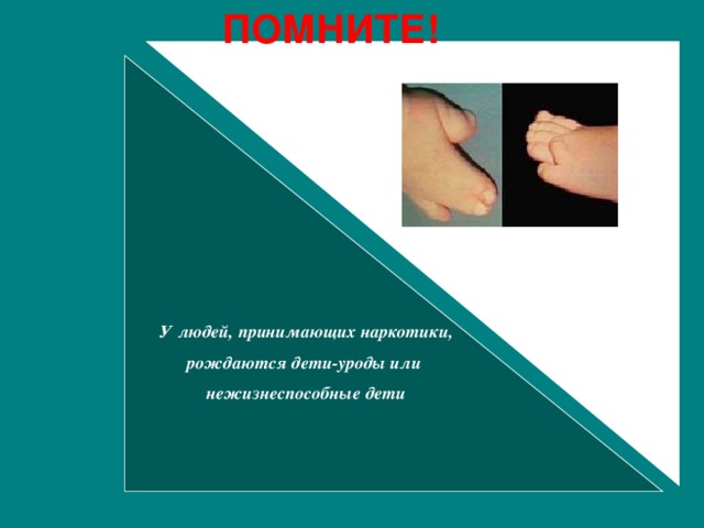 ПОМНИТЕ!   У людей, принимающих наркотики, рождаются дети-уроды или нежизнеспособные дети  У людей, принимающих наркотики, рождаются дети-уроды или нежизнеспособные дети   