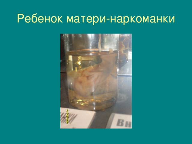 Ребенок матери-наркоманки 