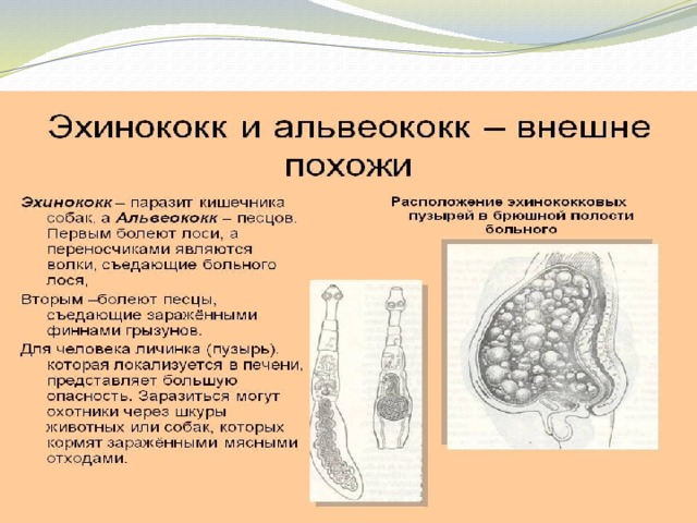 Заболевание печени. 