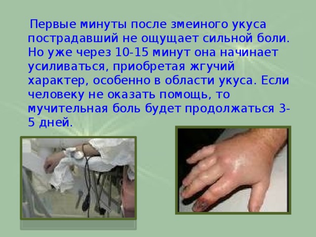  Первые минуты после змеиного укуса пострадавший не ощущает сильной боли. Но уже через 10-15 минут она начинает усиливаться, приобретая жгучий характер, особенно в области укуса. Если человеку не оказать помощь, то мучительная боль будет продолжаться 3-5 дней.   