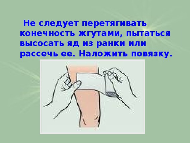  Не следует перетягивать конечность жгутами, пытаться высосать яд из ранки или рассечь ее. Наложить повязку. 