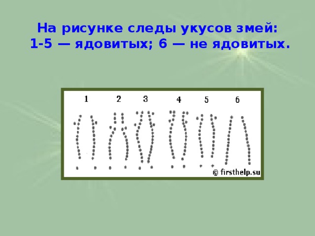 На рисунке следы укусов змей:  1-5 — ядовитых; 6 — не ядовитых.   