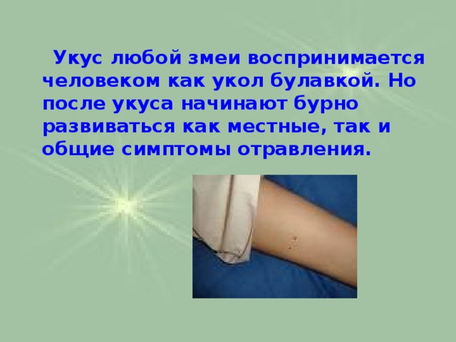  Укус любой змеи воспринимается человеком как укол булавкой. Но после укуса начинают бурно развиваться как местные, так и общие симптомы отравления.   