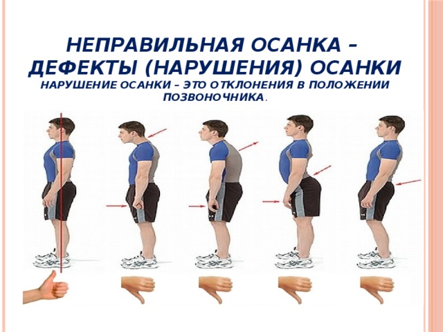 Моторные нарушения это