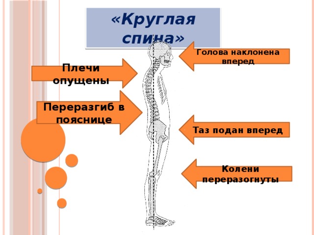 Круглая спина фото