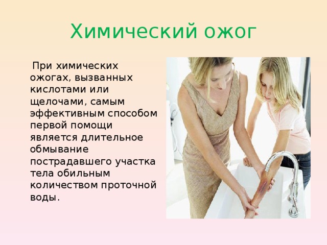 Химический ожог  При химических ожогах, вызванных кислотами или щелочами, самым эффективным способом первой помощи является длительное обмывание пострадавшего участка тела обильным количеством проточной воды. 