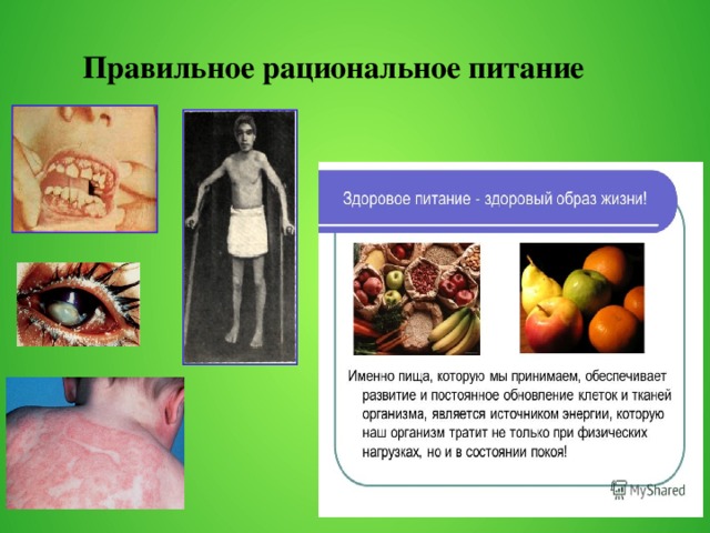  Правильное рациональное питание  