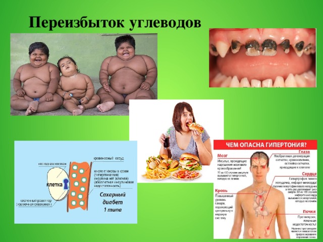 Вид кожи при избыточном питании. Недостаток углеводов. Переизбыток и недостаток углеводов в организме. Избыточное поступление углеводов. Избыток и недостаток углеводов в организме.