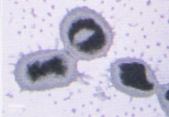 Налет на зубах под микроскопом фото