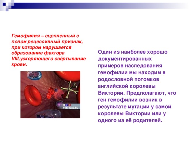Один из наиболее хорошо документированных примеров наследования гемофилии мы находим в родословной потомков английской королевы Виктории. Предполагают, что ген гемофилии возник в результате мутации у самой королевы Виктории или у одного из её родителей. Гемофилия – сцепленный с полом рецессивный признак, при котором нарушается образование фактора VIII ,ускоряющего свёртывание крови. 