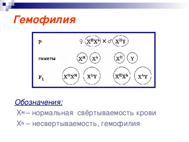 Гемофилия Обозначения:   Х Н  – нормальная свёртываемость крови  X h – несвертываемость, гемофилия 