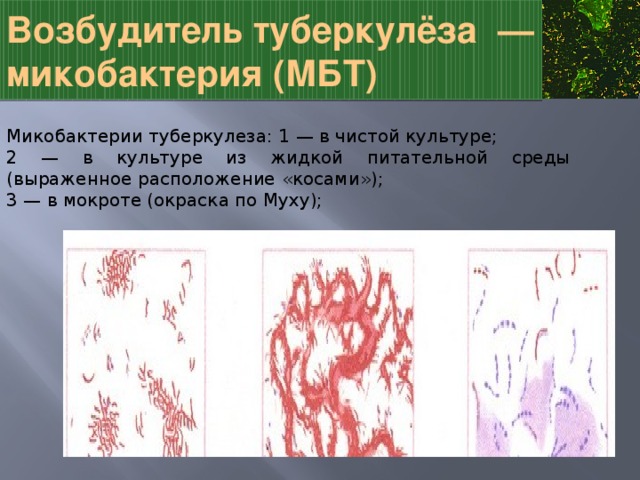 Выберите изображение с культурой мбт