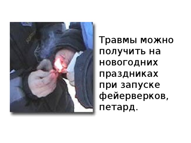 Травмы можно получить на новогодних праздниках при запуске фейерверков, петард. 
