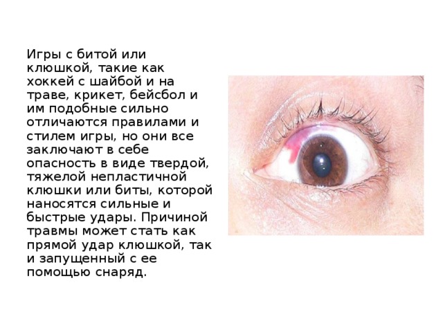 Игры с битой или клюшкой, такие как хоккей с шайбой и на траве, крикет, бейсбол и им подобные сильно отличаются правилами и стилем игры, но они все заключают в себе опасность в виде твердой, тяжелой непластичной клюшки или биты, которой наносятся сильные и быстрые удары. Причиной травмы может стать как прямой удар клюшкой, так и запущенный с ее помощью снаряд. 