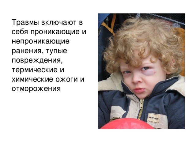 Травмы включают в себя проникающие и непроникающие ранения, тупые повреждения, термические и химические ожоги и отморожения 